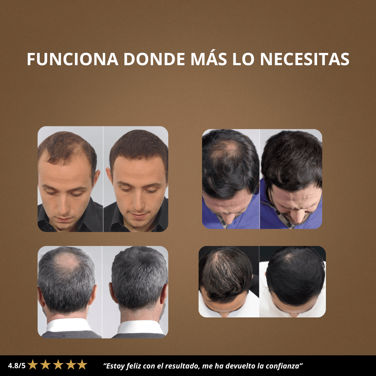 Keranox : Cabello con más volumen y confianza en solo 60 segundos