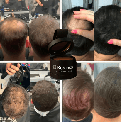 Keranox : Cabello con más volumen y confianza en solo 60 segundos